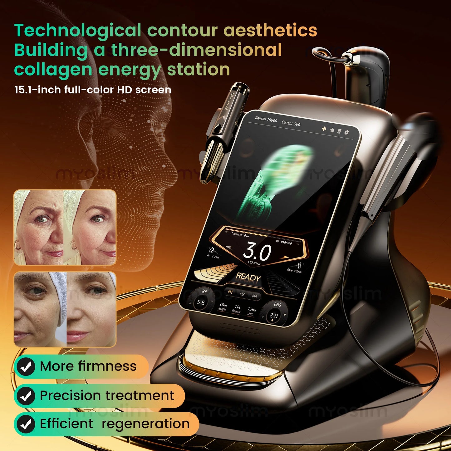 MYOSLIM Portable 360 Max RF EMS 3in1 Facial Beauty Device