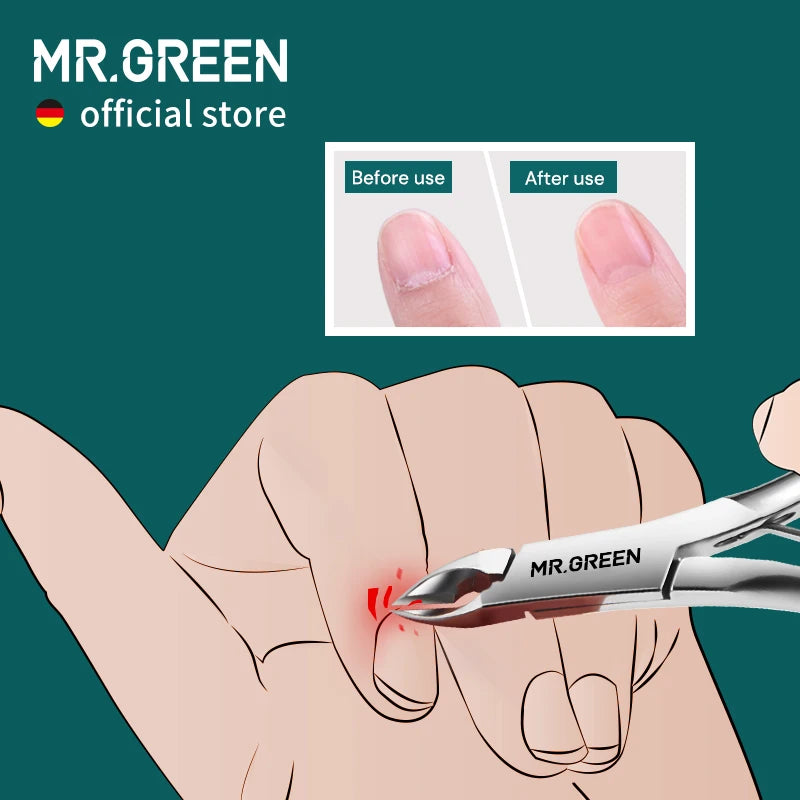 MR.GREEN Cuticle Nippers Stainless Steel Manicure Tool