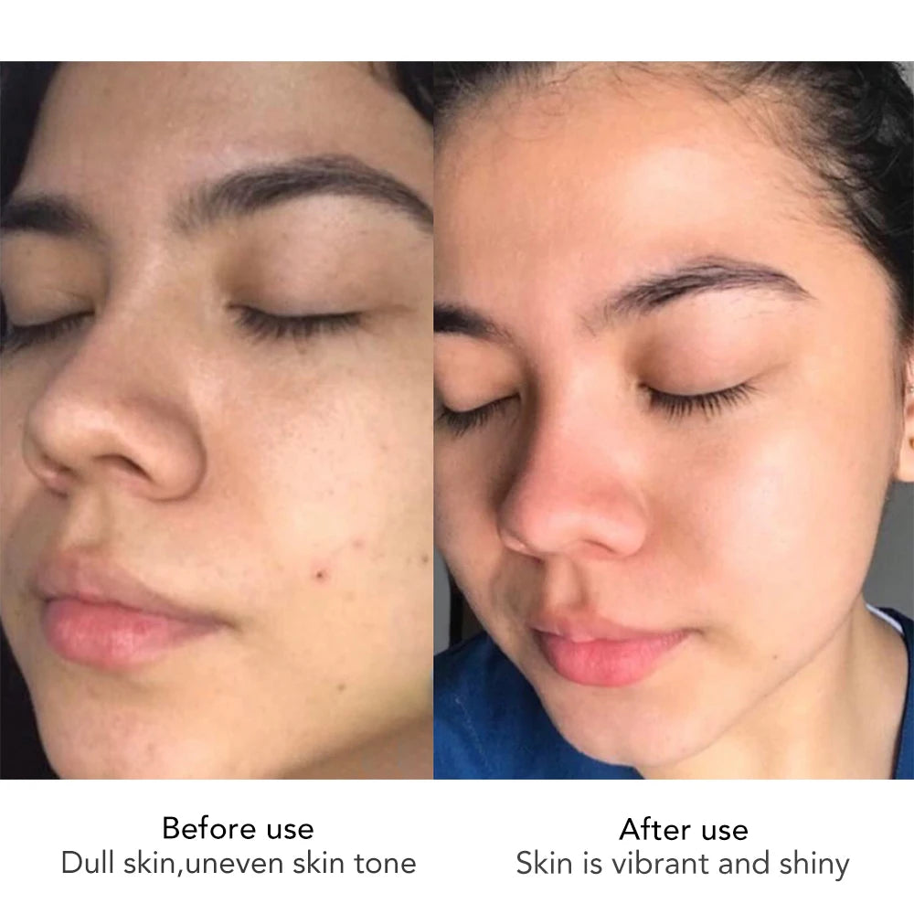 AILKE Hyaluron Face Cream Whitening Anti Aging Korean Skin Care