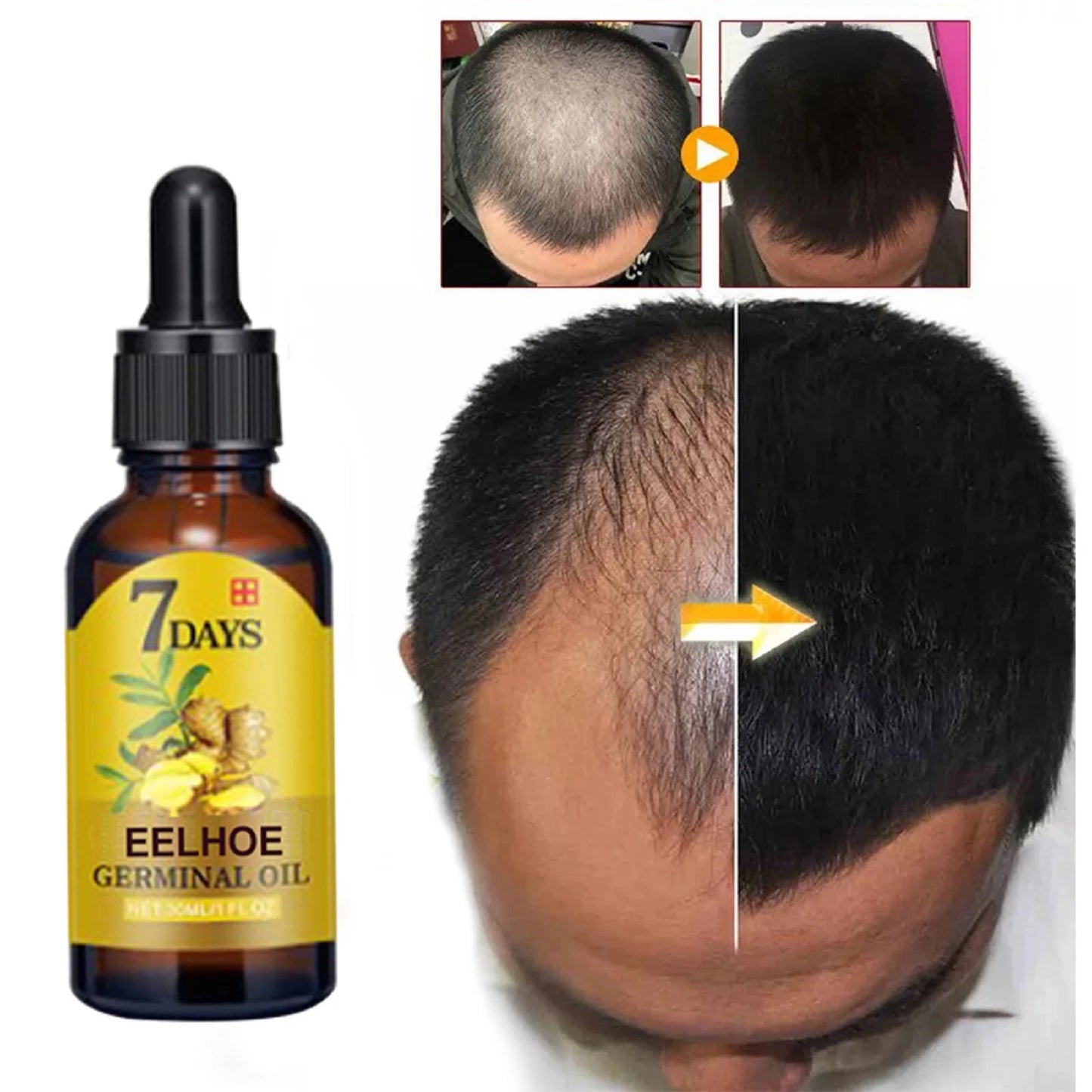 Eelhoe Ginger Hair Growth Oil Nourishment Anti Hair Loss