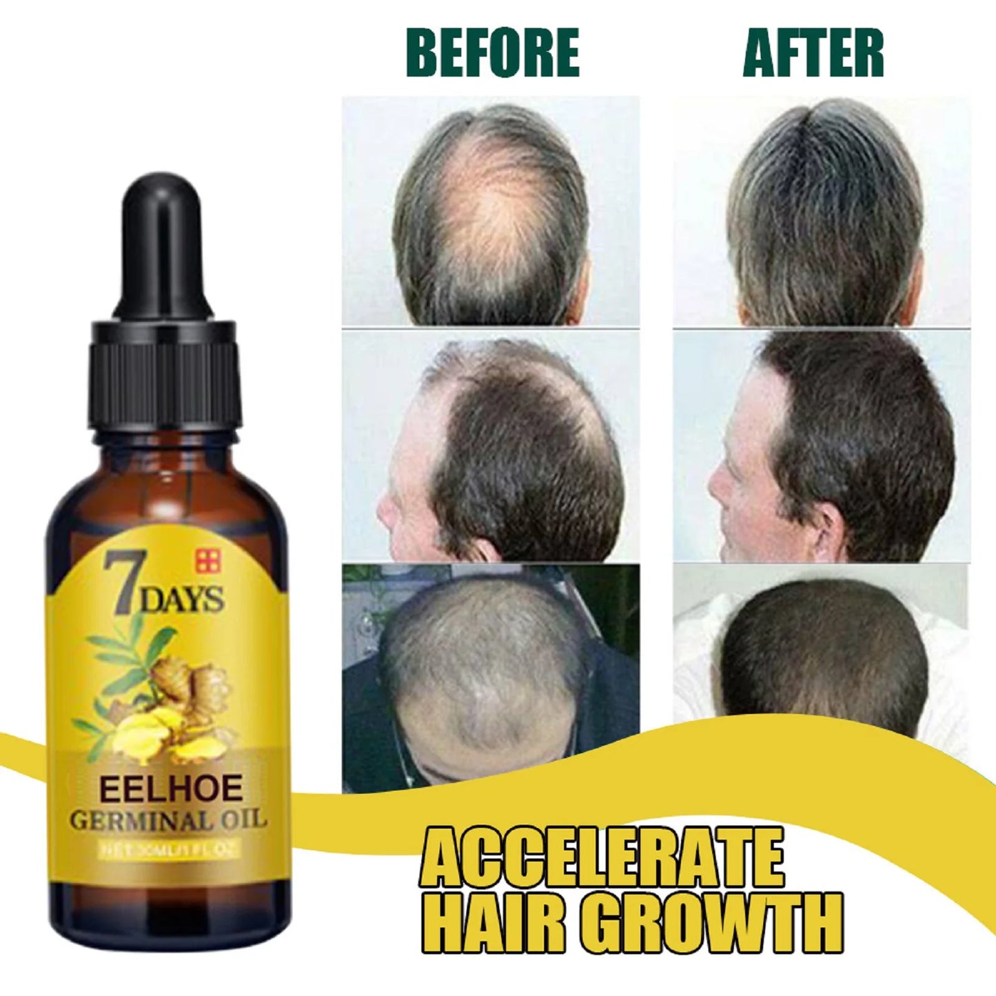 Eelhoe Ginger Hair Growth Oil Nourishment Anti Hair Loss