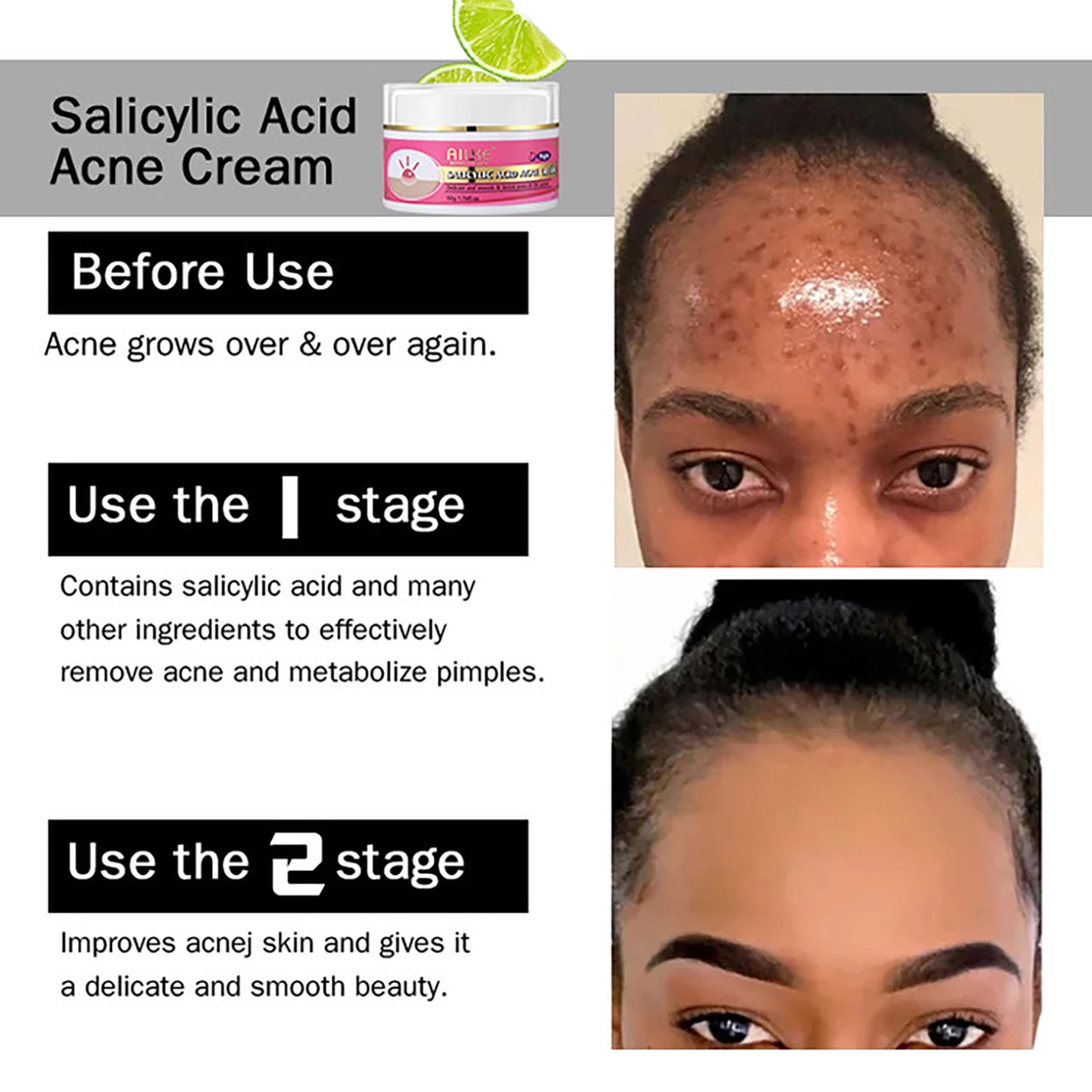 AILKE Skin Glowing Set Niacinamide Brightening Moisturizing Anti Acne Kit