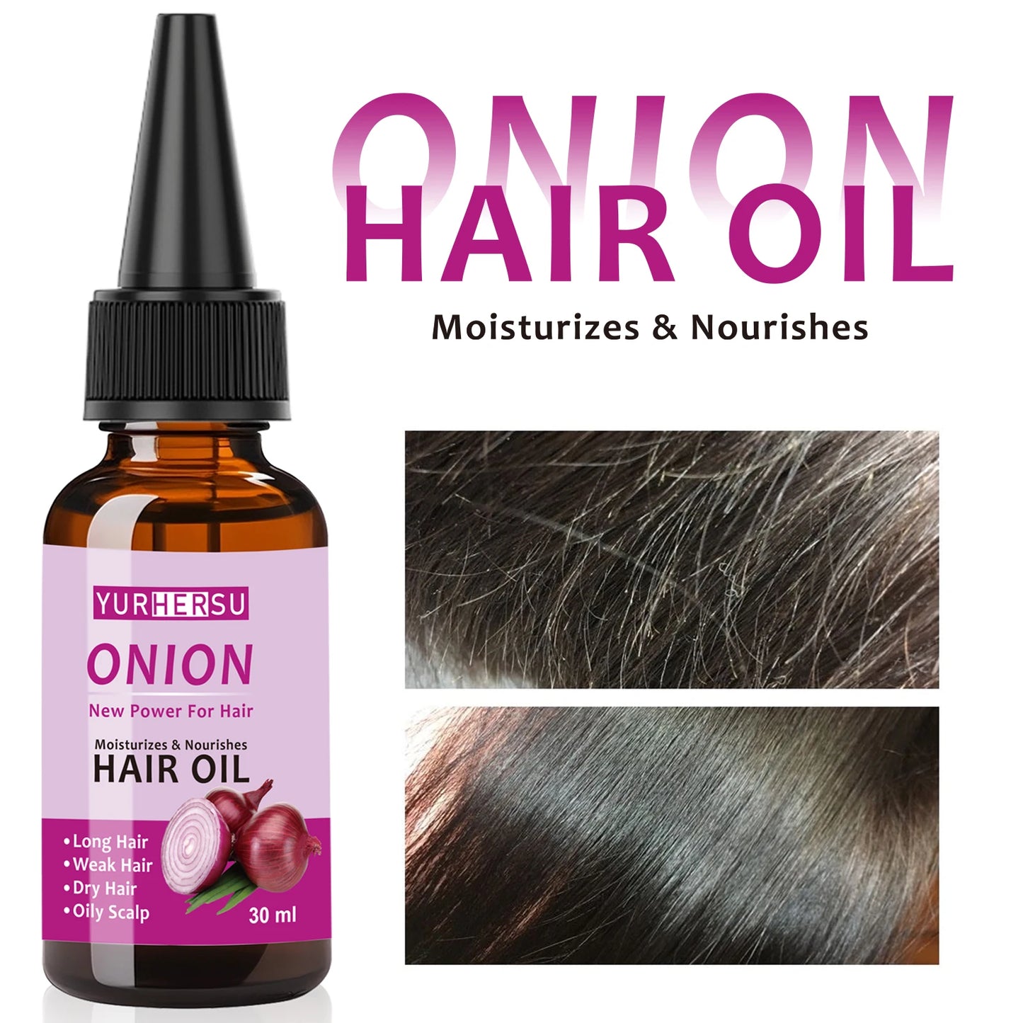 YURHERSU Onion Hair Oil For Fast Growth And Damage Repair