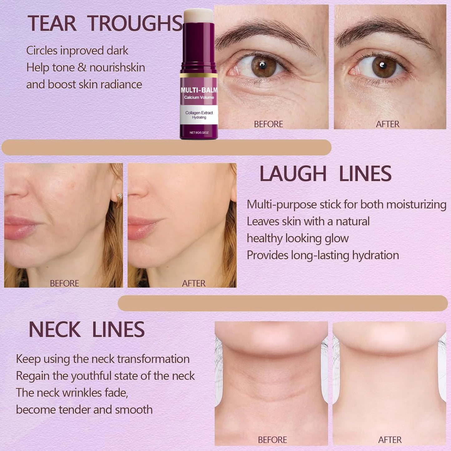 Eelhoe Korean Calcium Volume Multi Balm Stick Under Eye Hydrating Firming