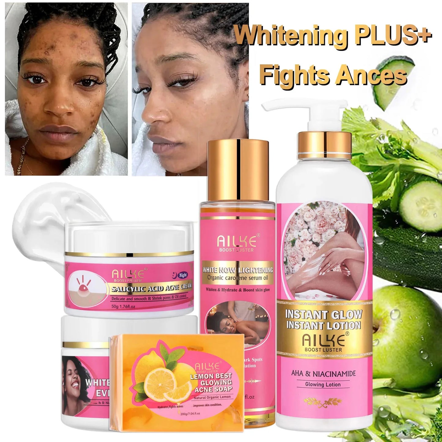 AILKE Skin Glowing Set Niacinamide Brightening Moisturizing Anti Acne Kit