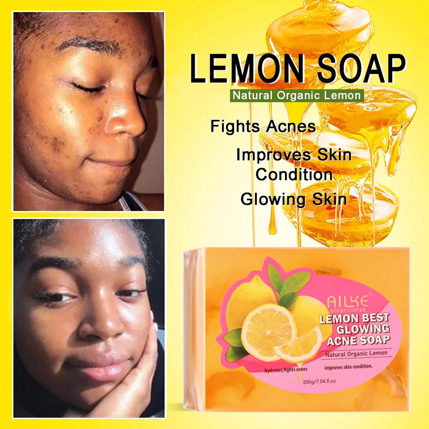 AILKE Skin Glowing Set Niacinamide Brightening Moisturizing Anti Acne Kit