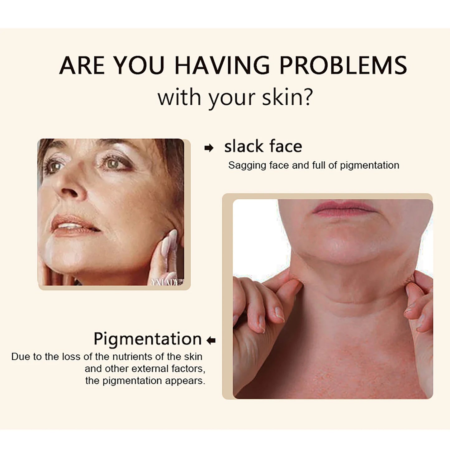 KYLIEFIT Collagen Whitening Essence For Facial And Body Brightening
