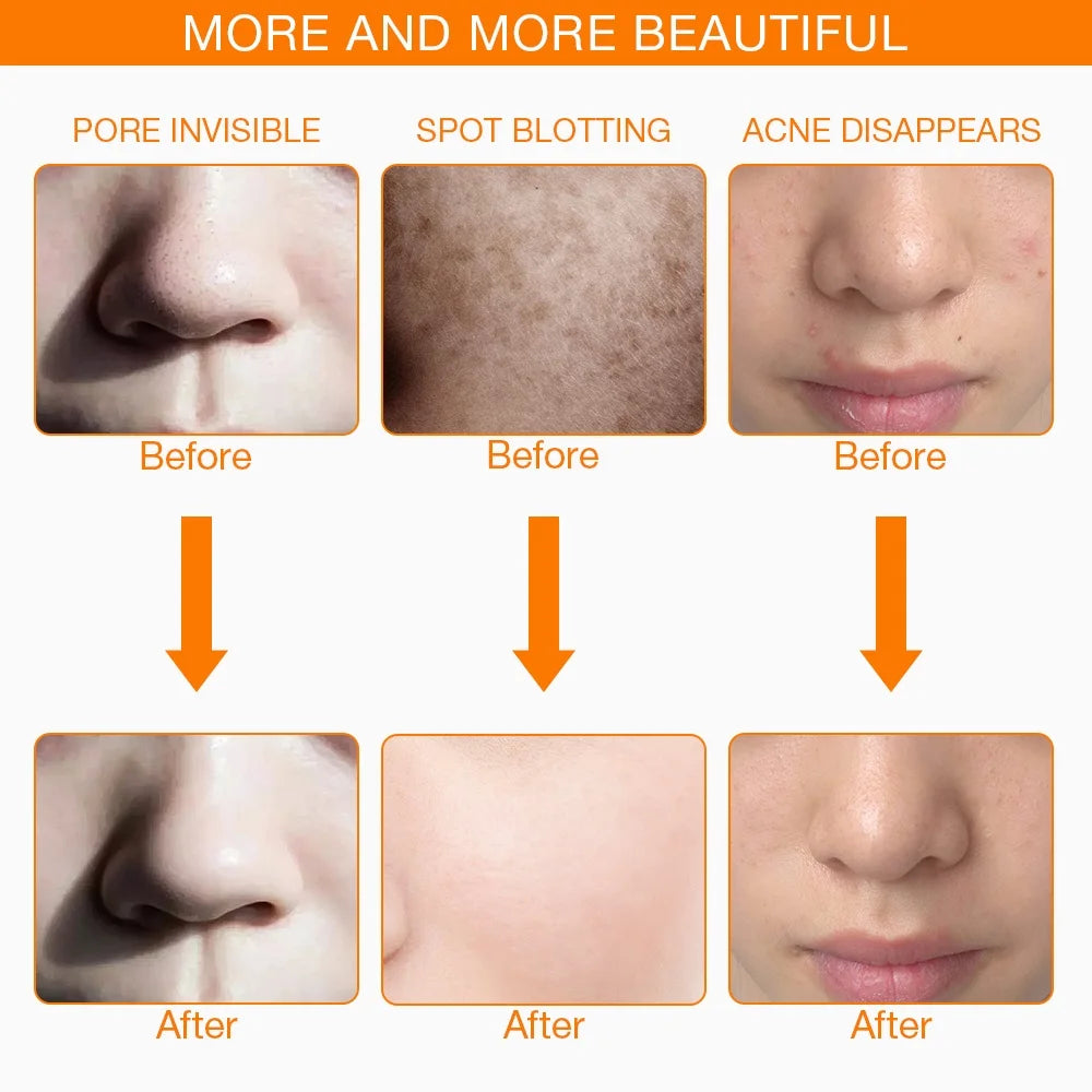 Iebilif LED Facial Mask For Skin Rejuvenation And Phototherapy Care