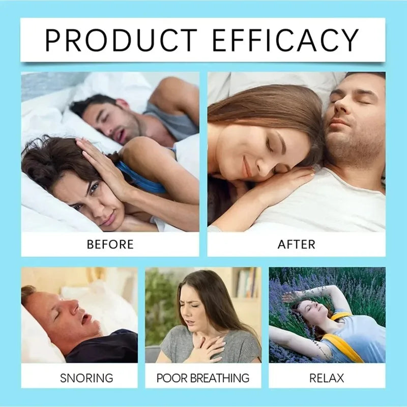 Nasal Breathing Dilators Magnetic Strips Improve Sleep And Reduce Snoring
