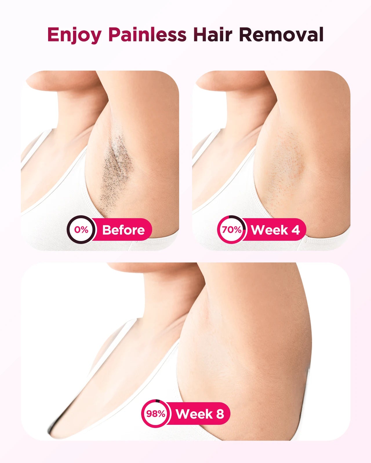 Totmizby IPL Laser Epilator Hair Removal Device For Body Facial