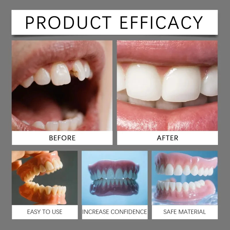 Silicone False Teeth Denture Kit For Decorative Upper Lower Veneers